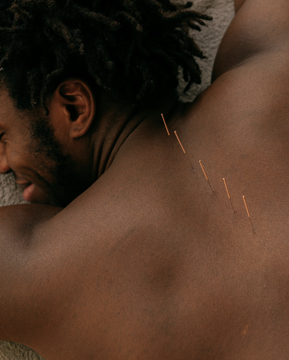 Acupuncture at Everwell